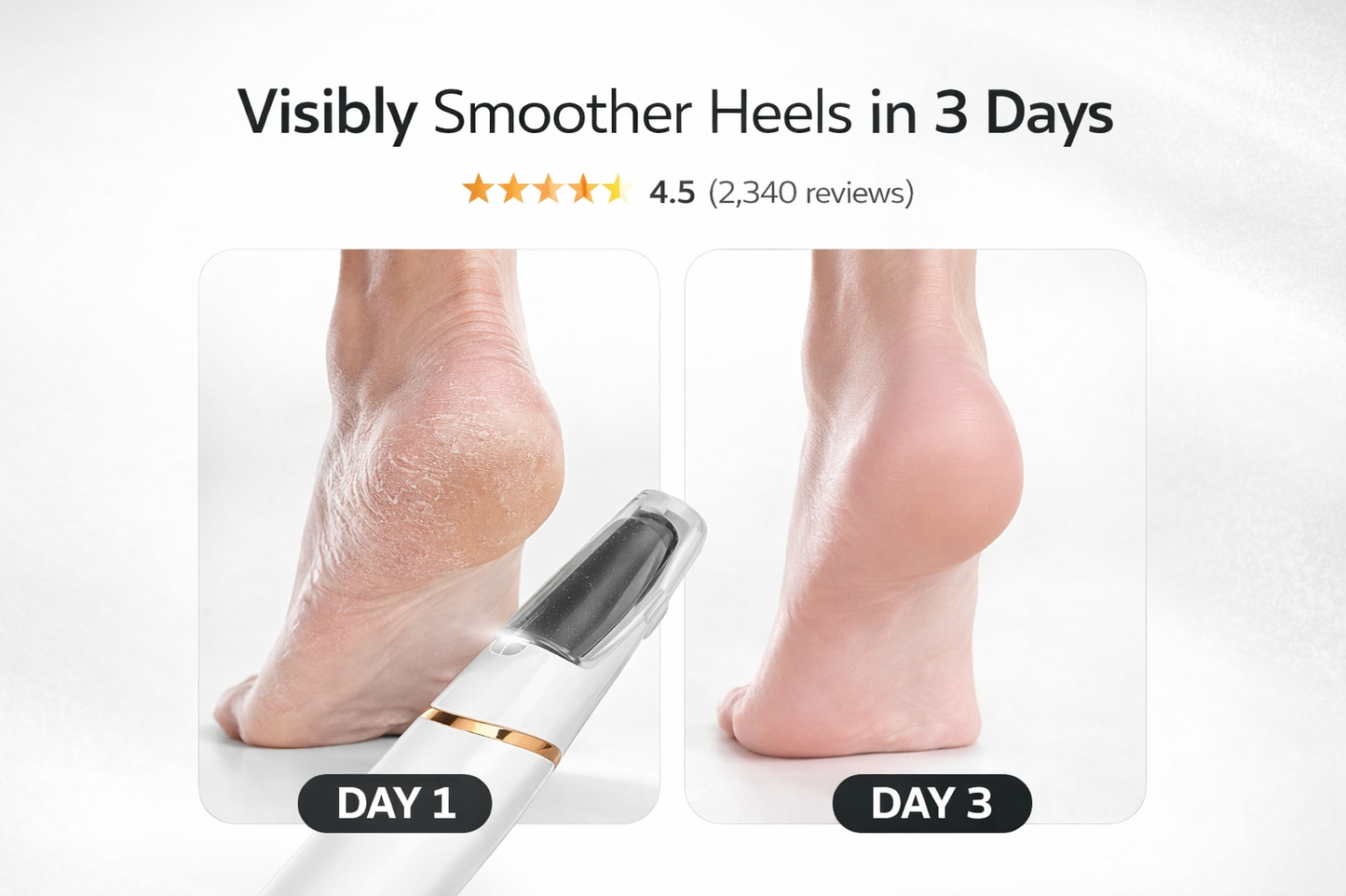 NoasisX Pro Foot Callus Care Bundle